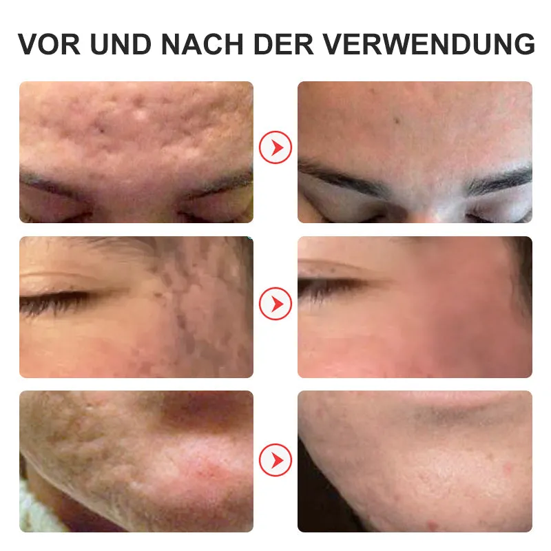 flysmus Niacinamid Pockmark Repair Essenz