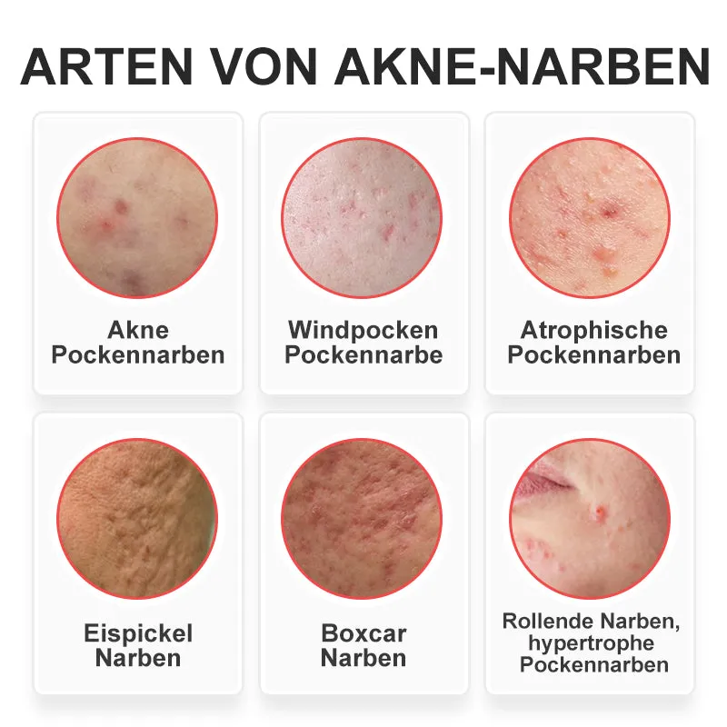 flysmus Niacinamid Pockmark Repair Essenz