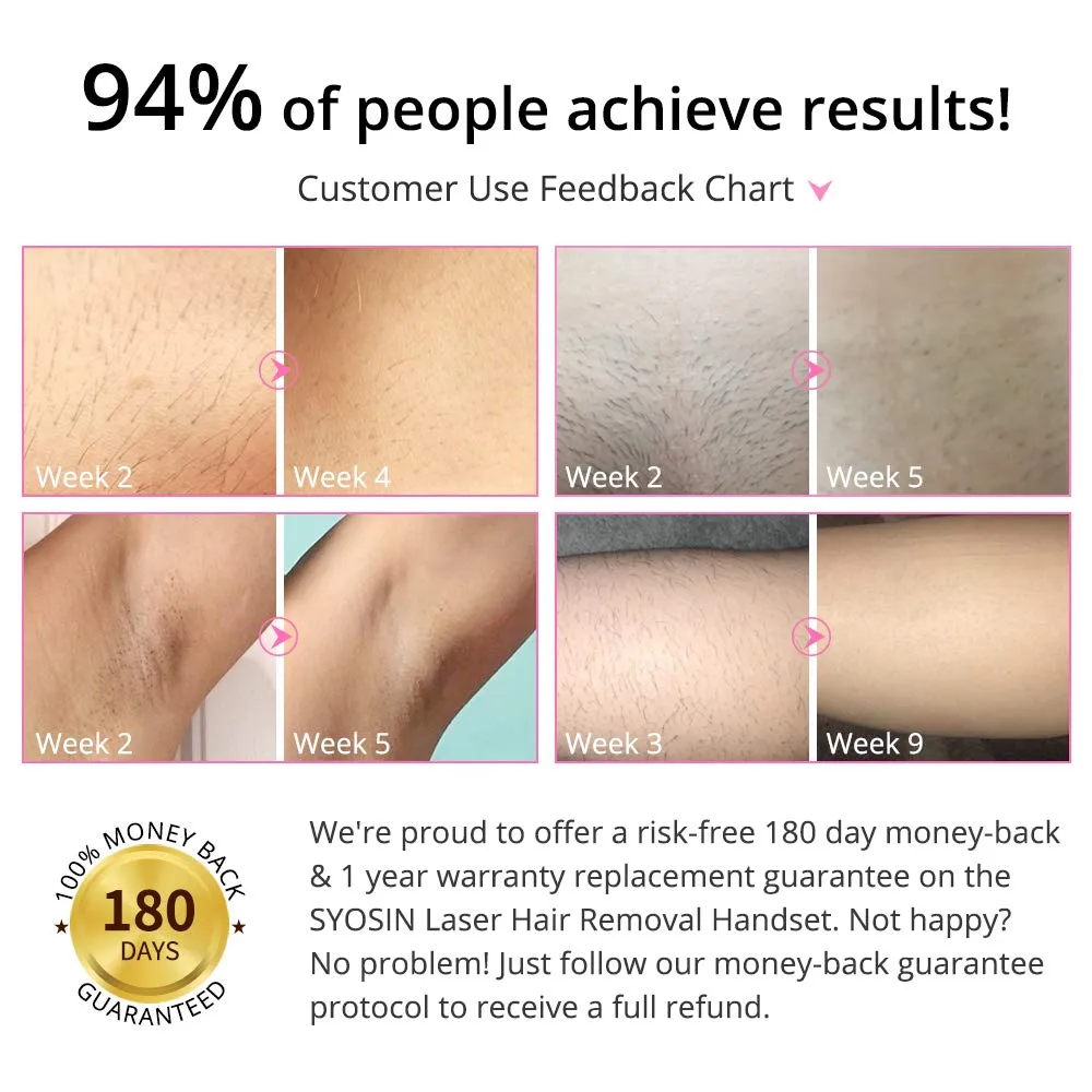 Professional IPL Hair Removal Device