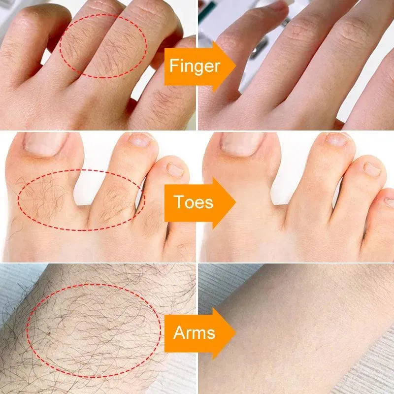 Smooth Skin Hair Removal Cream: Gentle & Effective Formula
