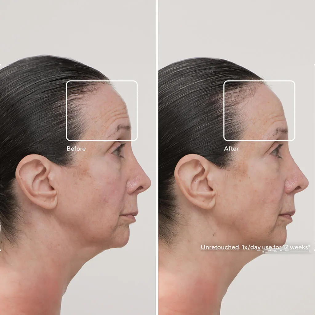 Thera Face Mask